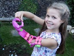 Childrens prosthetic limbs 02