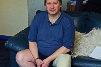 Scottish Amputee Has His PIP's Stopped